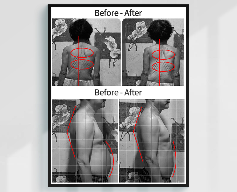 Before/After - 관리 결과